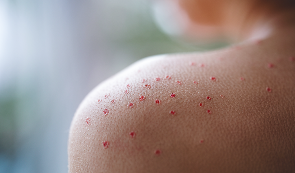 peau-gros-plan-points-rouges