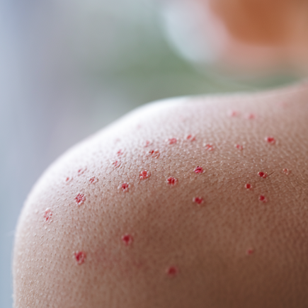 peau-gros-plan-points-rouges